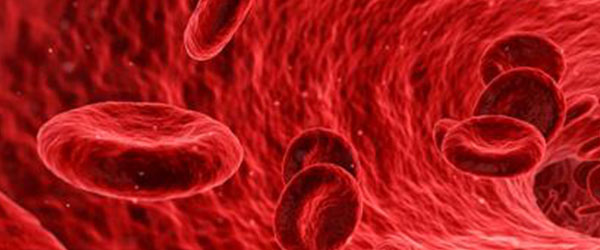 Il Ferro parte 1. Anemia e iperferritinemia.